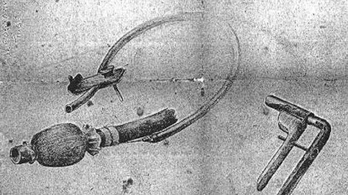 This sketch of a self-retaining ileostomy tube, designed and made by Vaughan at Chungkai POW hospital camp in Thailand in 1943, also featured in the exhibition (courtesy LSTM)