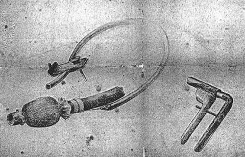 This sketch of a self-retaining ileostomy tube, designed and made by Vaughan at Chungkai POW hospital camp in Thailand in 1943, also featured in the exhibition (courtesy LSTM)